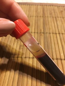 铲子哪个公司的品牌好？我的真实体验告诉你
